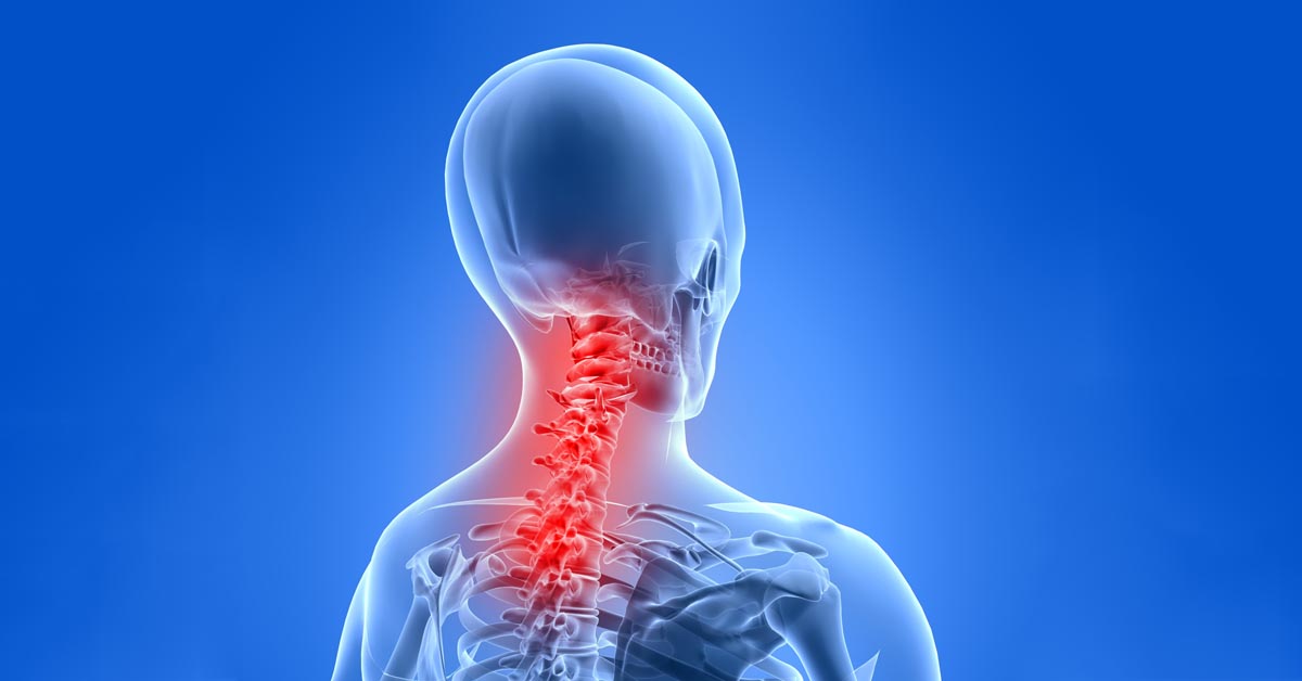 Massillon car accident and neck pain treatment